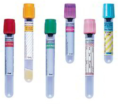 Claro - tubo superior azul Vial For Blood Collection da amostra do EDTA do sangue