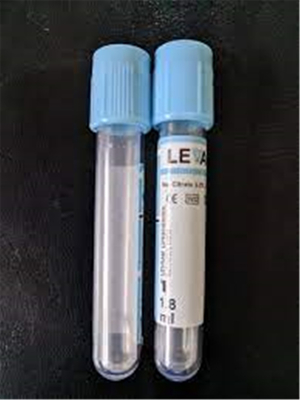 Os tubos de ensaio da coleção da amostra de sangue do EDTA coagulam o tubo do ativador do coágulo